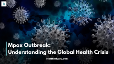 Mpox Outbreak: Understanding the Global Health Crisis