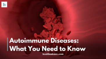 Autoimmune Diseases: What You Need to Know