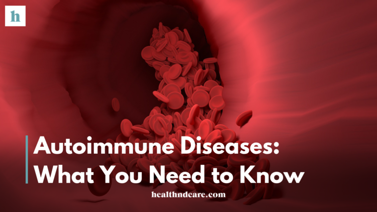 Autoimmune Diseases: What You Need to Know